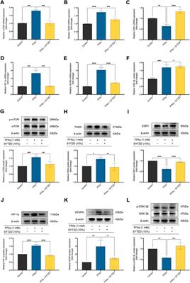 Shuangyu Tiaozhi decoction alleviates non-alcoholic fatty liver disease by improving lipid deposition, insulin resistance, and inflammation in vitro and in vivo